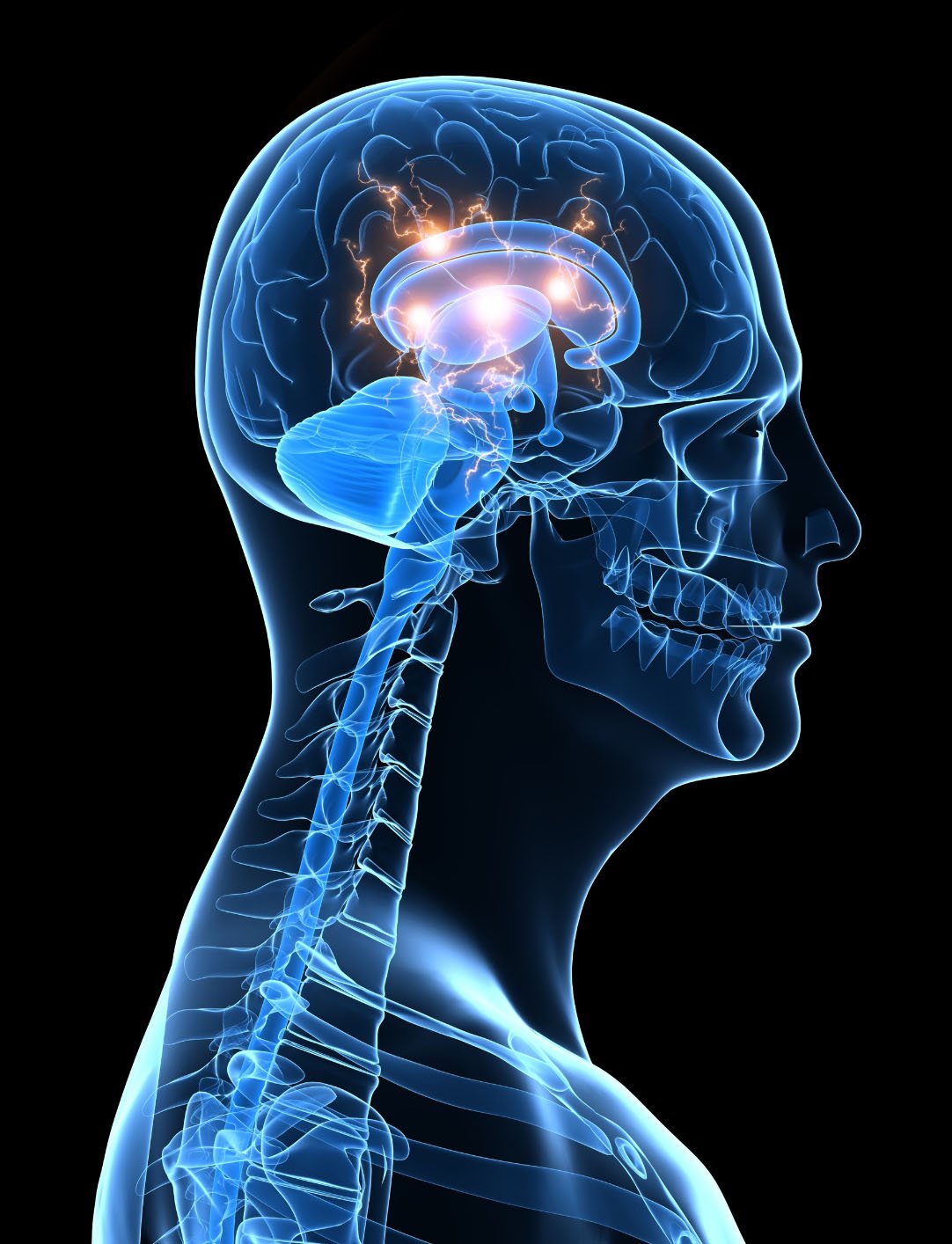 Veterans with Traumatic Brain Injury